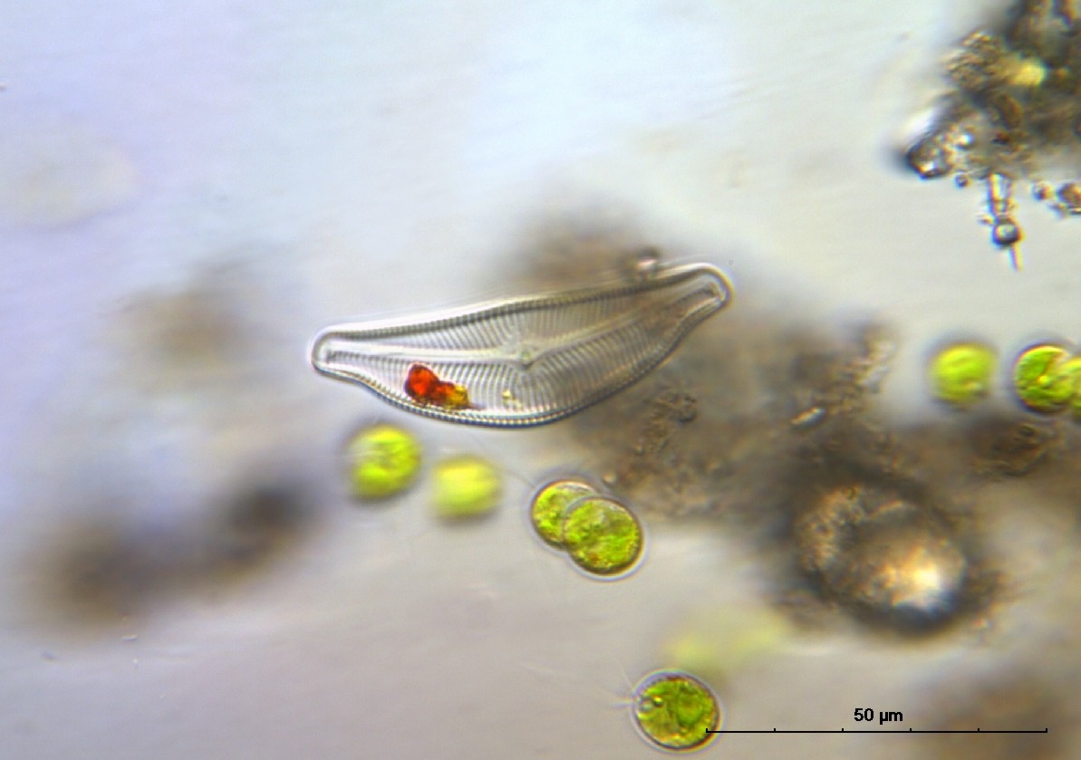 Cymbella con Haematochoccus